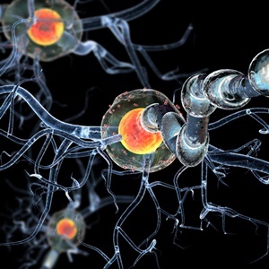 A new sub-type of multiple sclerosis (MS) has been identified. 