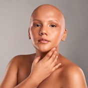 The bald and the beautiful: Breaking the stigma around female hair loss