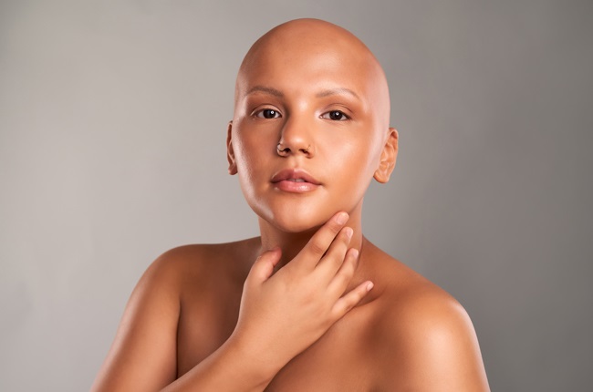 The bald and the beautiful: Breaking the stigma around female hair loss |  Life