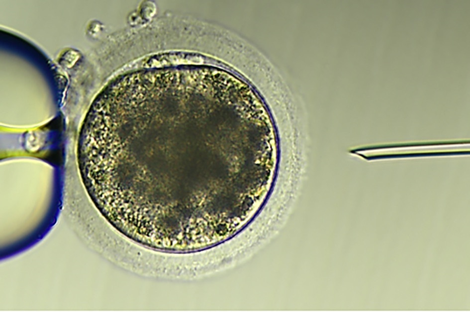 ’n Tegniek genaamd intrasitoplastiese sperm-inspuiting is gebruik om die wêreld se eerste kunsmatig bevrugte donkie-embrio te skep. FOTO: UNIVERSITEIT VAN QUEENSLAND