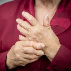 Rheumatoid arthritis affects many joints on both sides of the body. 