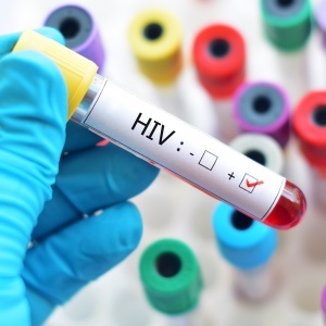 Being positive about one's HIV status can be an inspiration to others. 