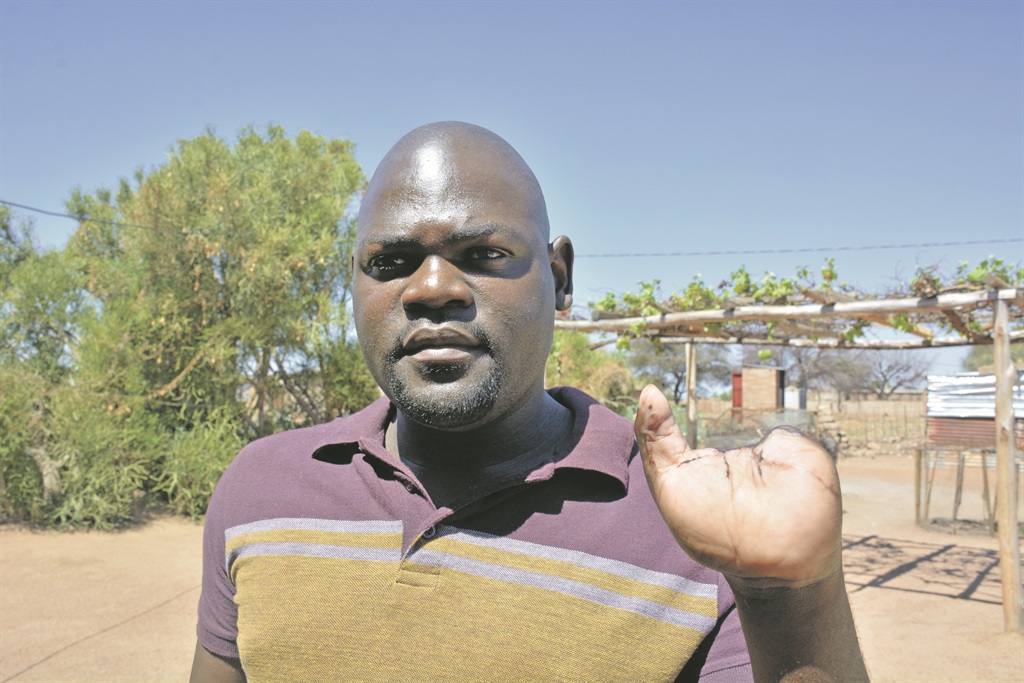 Believe Makhubela from Winterveld in Tshwane fears his fingers could be used for muthi.   Photo by  Morapedi Mashashe
