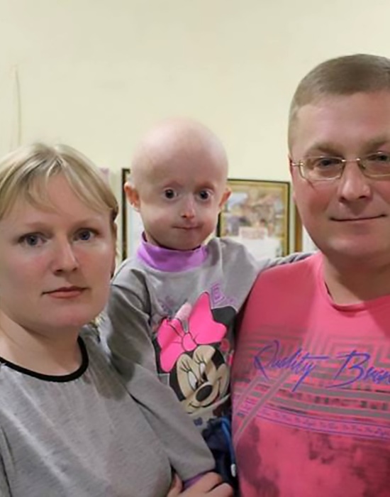 Hope For 8 Year Old Ukrainian Girl With Progeria Parent24