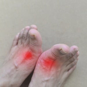 A new, injectable medicine can help ease gout. 