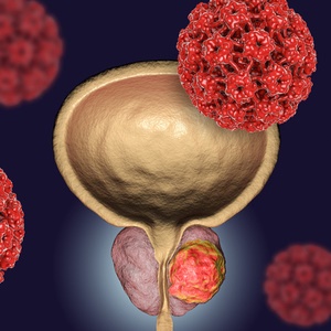 Could this otherwise deadly poison help people in the fight against bladder cancer?