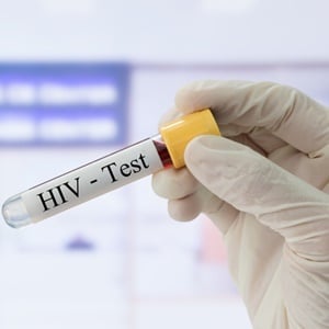 Mandatory testing could slow down the rate of new infections and help those who were unaware of their HIV status. 