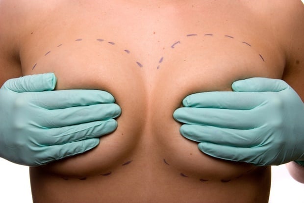 Body, breast reconstruction, nipples