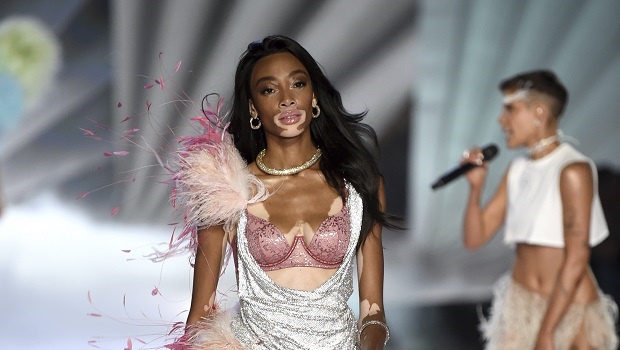 Winnie Harlow walks the runway during the 2018 Victoria's Secret Fashion Show at Pier 94 on Thursday, Nov. 8, 2018, in New York. 