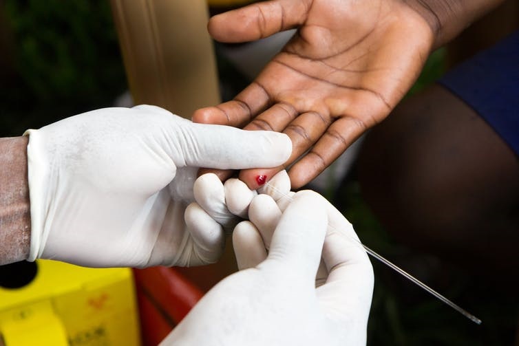 SA has used the HIV Rapid Diagnostic Tests (Finger prick – same-day testing) for years. Picture: Shutterstock