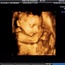 Foetal kicks may help babies understand their bodies