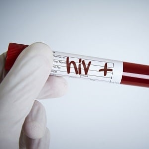 Test that shows you're HIV-positive.