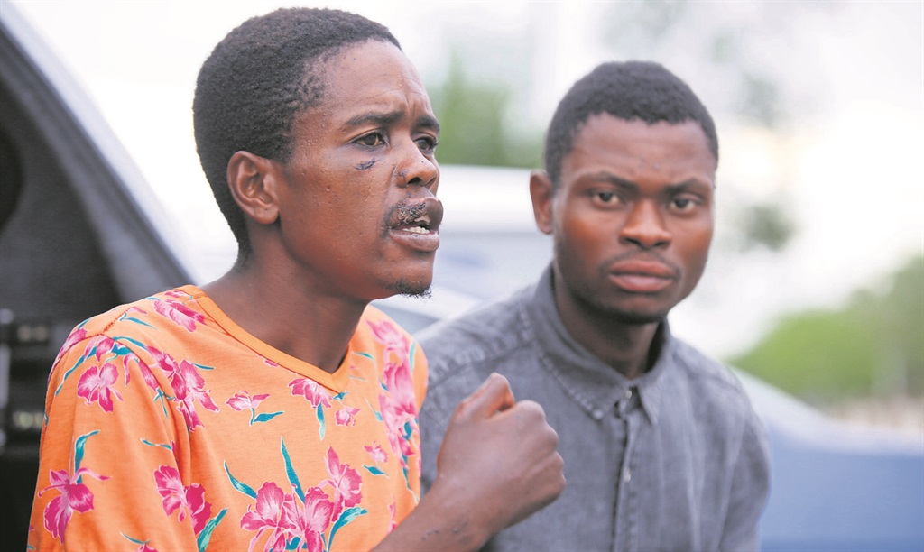 John Marakalala (left) ended up with an injured face and his friend Mpho Moremi says he was slapped by Mahwelereng police.                            Photo by Joshua Sebola