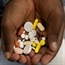 Africa's deadly combo: HIV-TB