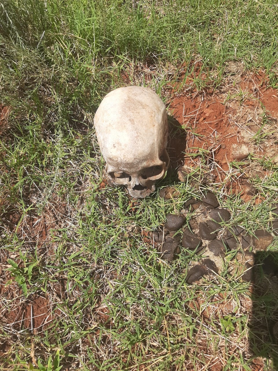 A human skull that was found on the scene. Photo Supplied 