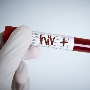 Tests can show if you're HIV-positive.