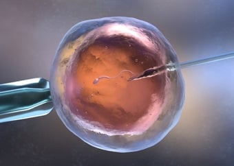 Trying? Here are 5 important things you need to know about IVF