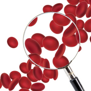 Anaemia can have a negative effect on your health. 