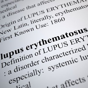 Lupus affects the immune system. 
