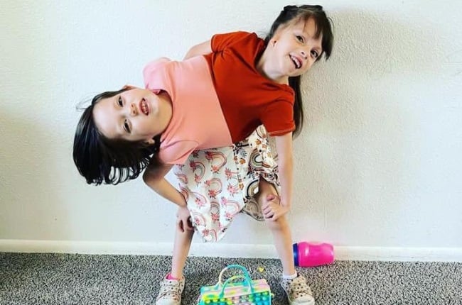 Callie and Carter Torres  are six-year-old conjoined twins from Idaho in the US. (PHOTO: Instagram/@callieandcarterbeatodds)