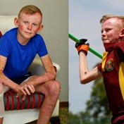 A rare skin condition hasn't stopped this boy from dreaming of being a farmer one day
