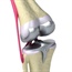 The value of alternative knee replacement treatment