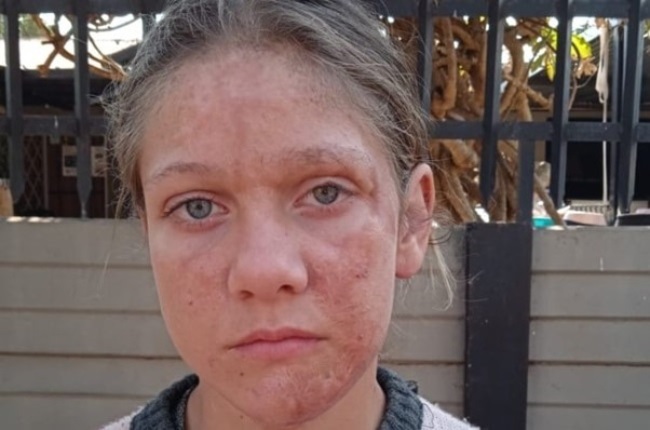 Elizabeth Trollip (14) is trying to cope with the devastating effects of a gas explosion that destroyed her home. (PHOTO: Supplied)