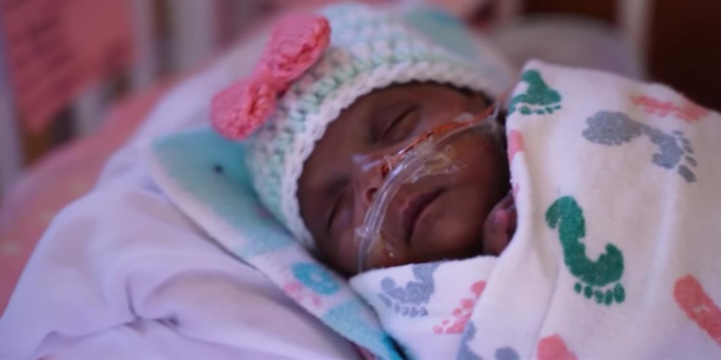The 'world's smallest' surviving premature baby who ...