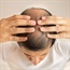 Can stem cells be the cure for baldness?