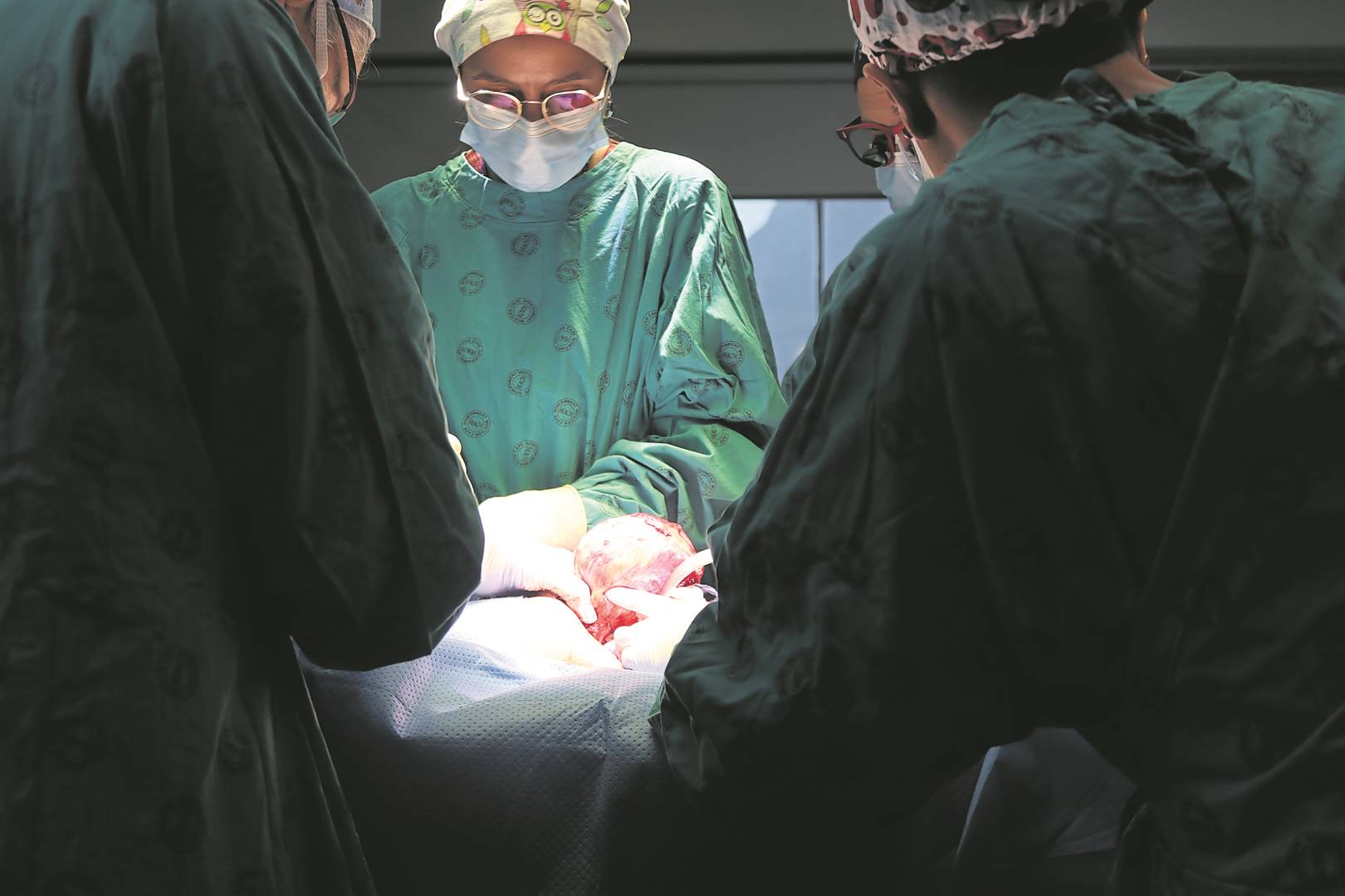A team of specialised surgeons remove a Wilms tumour from a 4-year-old patient. PHOTO: KAYLYNNE BANTOM