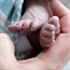 One-month-old baby has his penis amputated after botched circumcision
