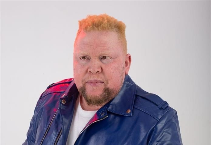 Gospel musician Sgwili Zuma raises awareness against the killing of people with albinism. 