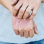 Psoriasis, mental ills can go hand in hand