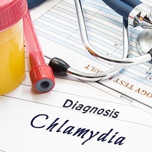 Chlamydia could interfere with male fertility. 