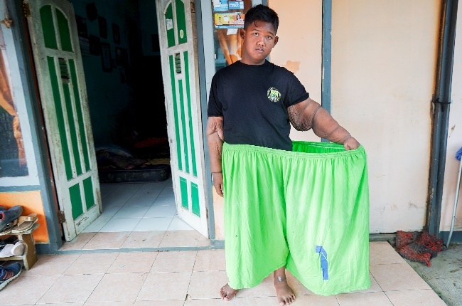 Teenager Arya Permana weighed almost 200kg. (Photo: Gallo Images/Getty Images) 