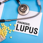 Lupus not a condition that is spread