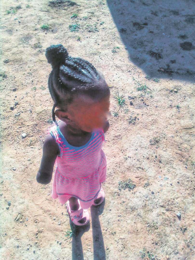  Lwandle’s arm was amputated after birth because of alleged medical negligence at the Bernice Samuel Hospital in Delmas Photo: supplied 