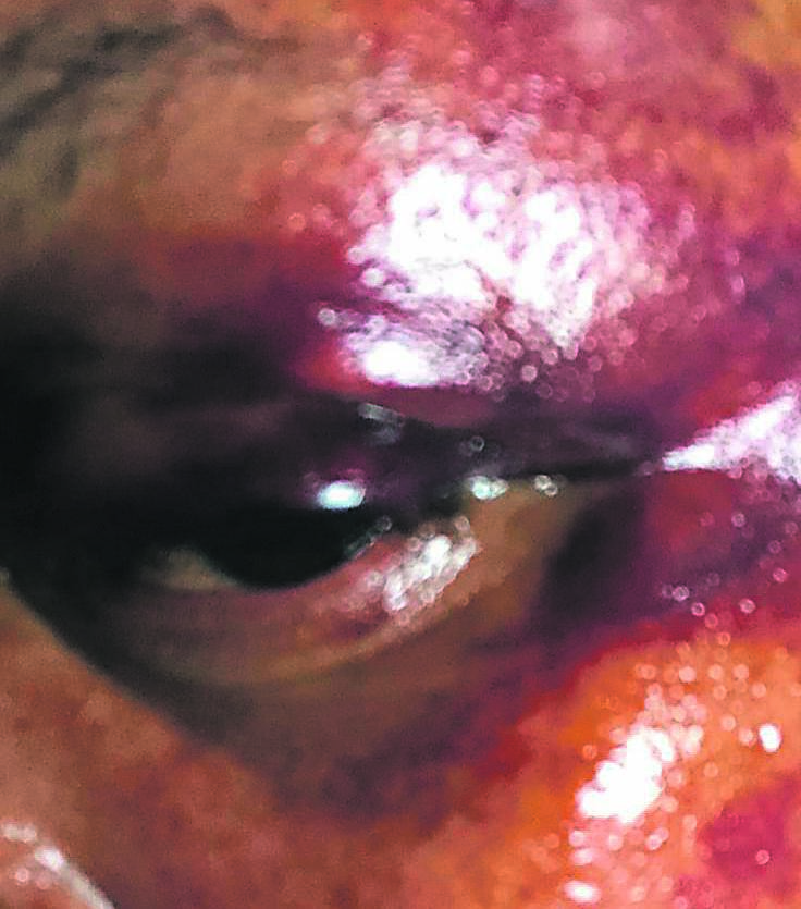 sore sight A woman claims her husband physically attacked her 