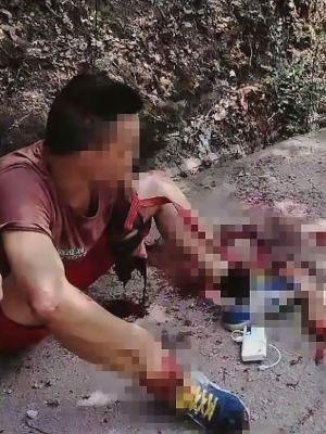 The 37-year-old man collected the severed limb and returned to the roadside to calmly sit and wait for help. (Photo: ASIA WIRE/MAGAZINEFEATURES.CO.ZA)