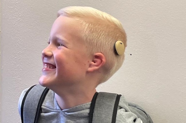 Eli is the fifth person in SA to receive an Osia System hearing implant. (PHOTO: Supplied) 