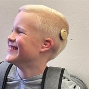 Hearing implant gives gift of sound to boy born with missing ear canal