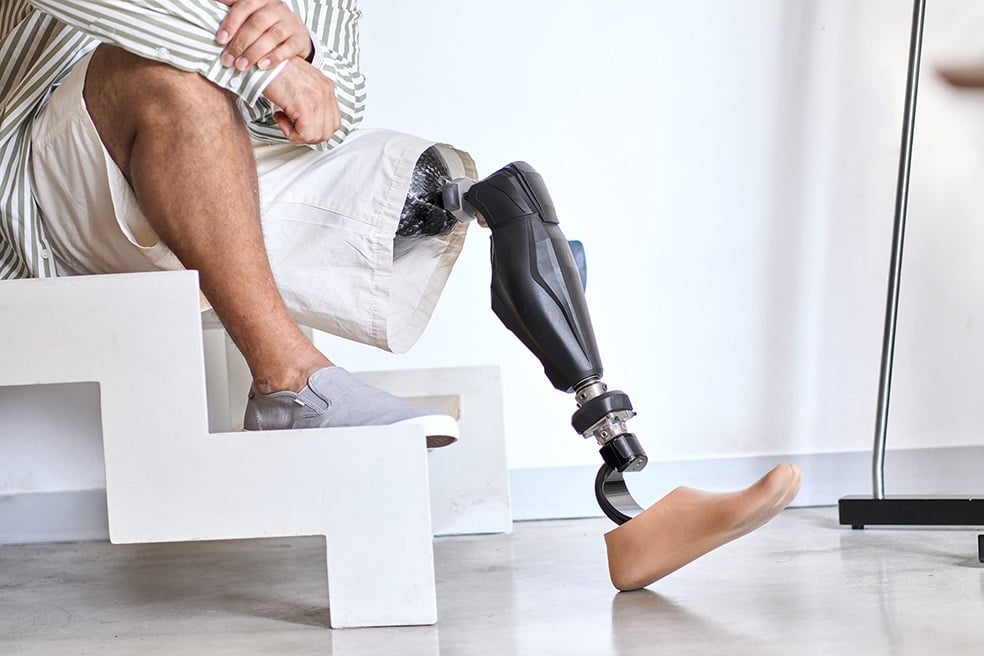 Marco du Plooy has gained an international reputation for excellence in the field of prosthetics.
