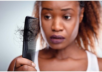 What to know about hair loss as a Black woman