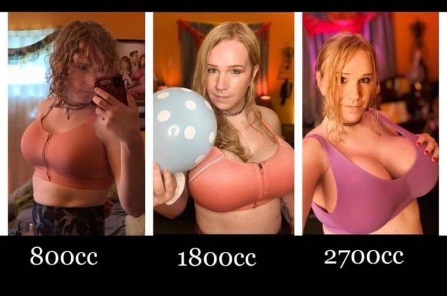Woman holds record for largest breasts