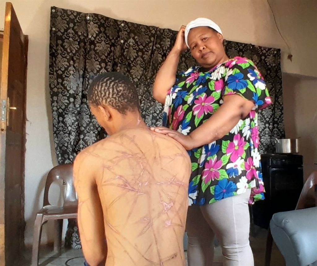 The injured Velile Mbambane with his aunt Marry Mbambane. Photo by Tumelo Mofokeng