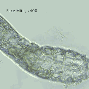 A face mite, magnified at 400x. Face Mite Your Wild Life NCSU
