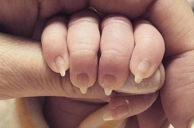 A mom recently came under fire when a photo of her baby's "manicure" was shared online. (Photo: Reddit/ u/renaissance_witch) 