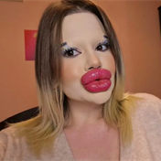After 43 lip procedures, 25-year-old says 'extravagant appearance' hinders her love life