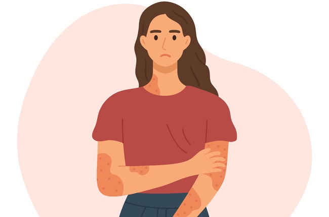 Aside from battling painful physical symptoms, those who have psoriasis are often haunted by hurtful stereotypes and misconceptions associated with the condition. 