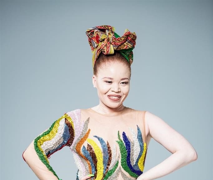 South African actress, TV presenter and activist Puleng Molebatsi said people with albinism are doing well.